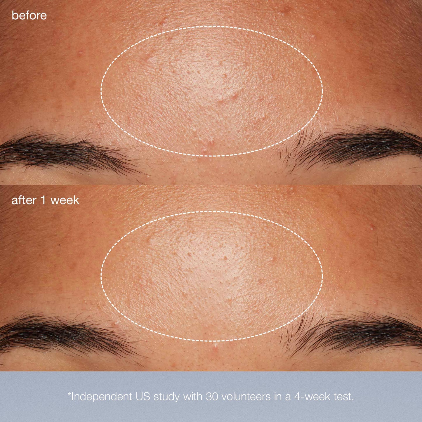 daily microfoliant clinical